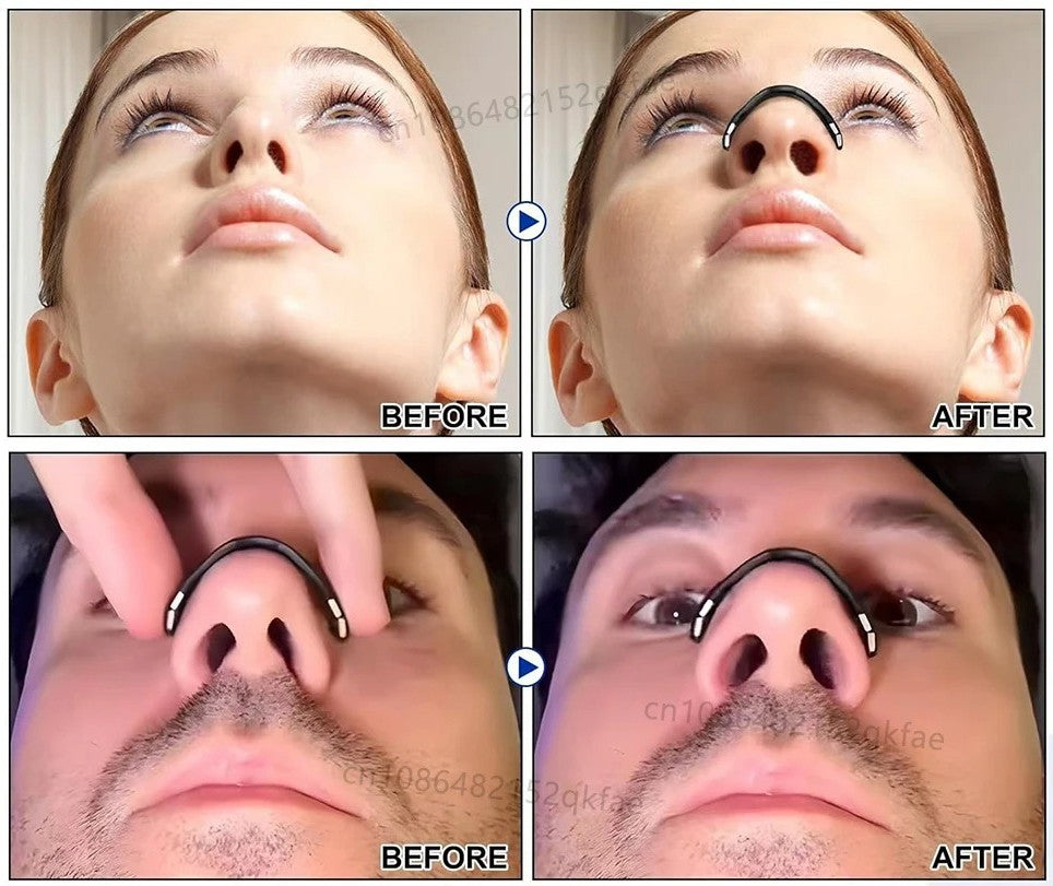 AirHalo Nasal Breathing Support Kit