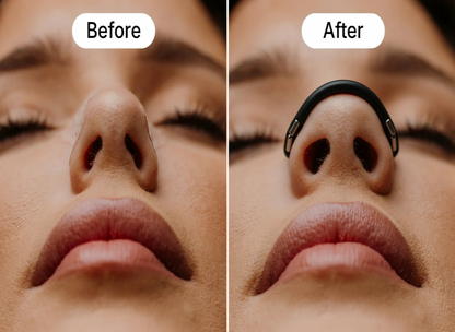 AirHalo Nasal Breathing Support Kit